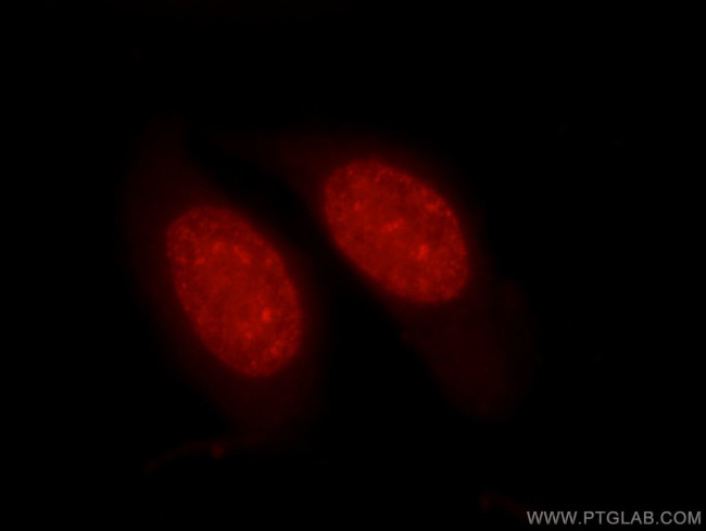Histone H1.0 Antibody in Immunocytochemistry (ICC/IF)