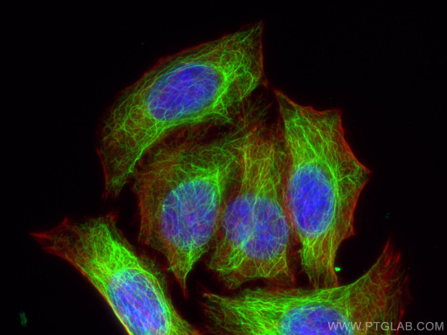 Cytokeratin 7 Antibody in Immunocytochemistry (ICC/IF)