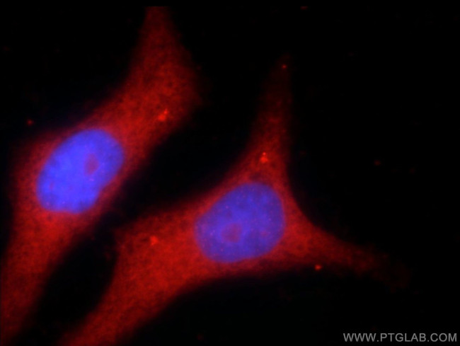 RIPK1 Antibody in Immunocytochemistry (ICC/IF)
