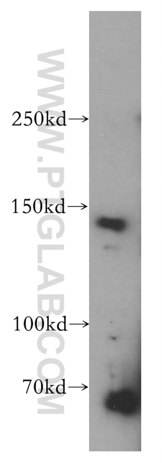 POLR3A Antibody in Western Blot (WB)