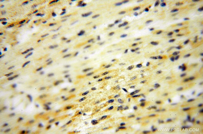 DNAI2 Antibody in Immunohistochemistry (Paraffin) (IHC (P))