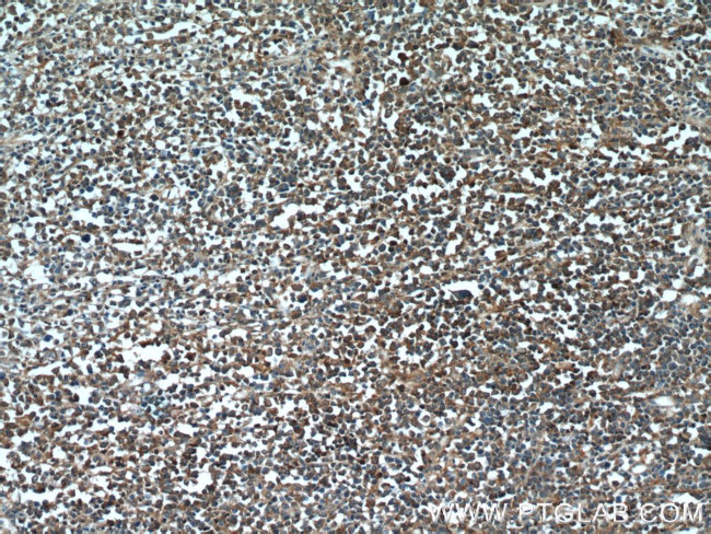 PARP9 Antibody in Immunohistochemistry (Paraffin) (IHC (P))