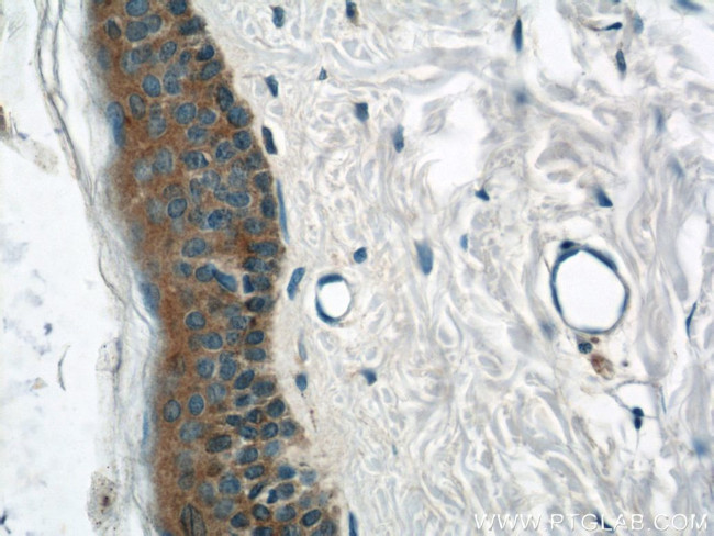 TRIM29 Antibody in Immunohistochemistry (Paraffin) (IHC (P))