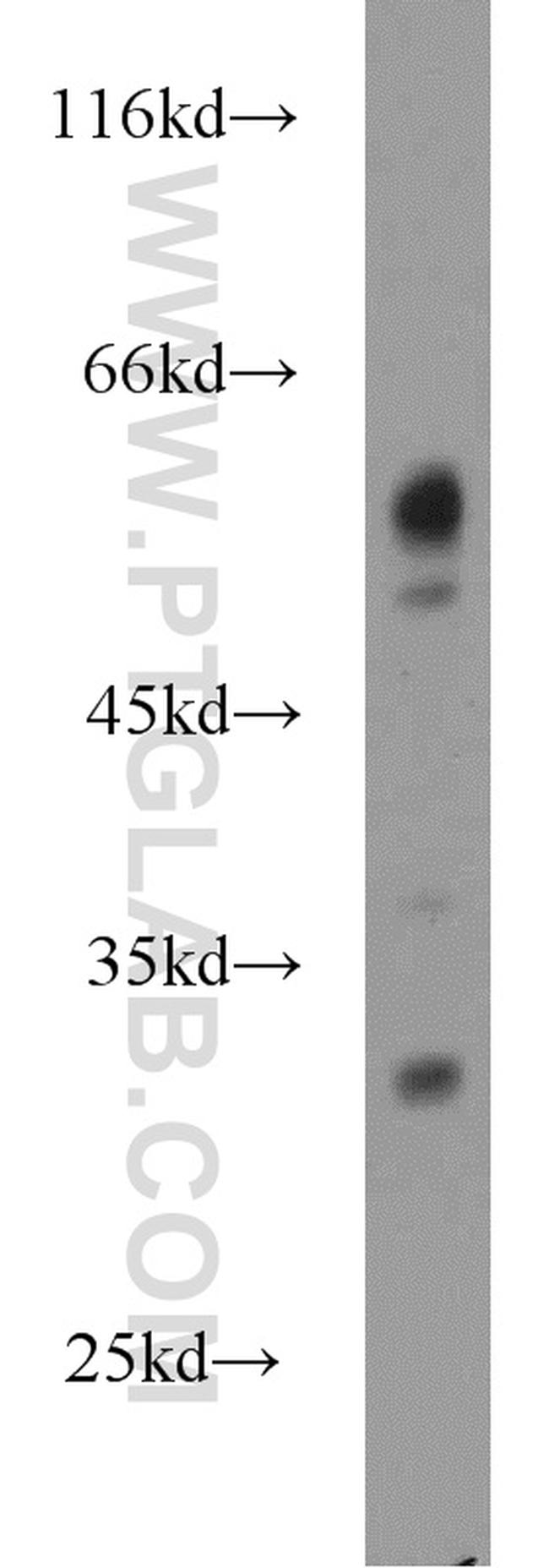 MIER3 Antibody in Western Blot (WB)