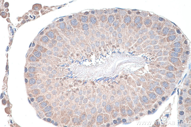 NSUN7 Antibody in Immunohistochemistry (Paraffin) (IHC (P))