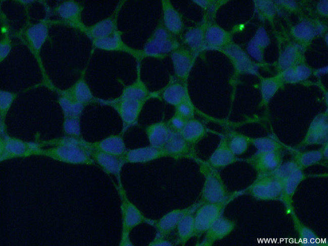 PIP5KL1 Antibody in Immunocytochemistry (ICC/IF)