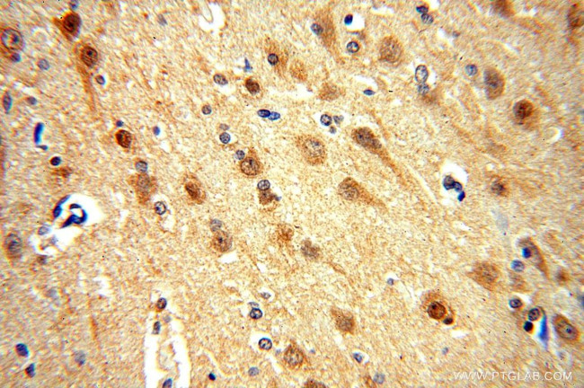 PTPN18 Antibody in Immunohistochemistry (Paraffin) (IHC (P))