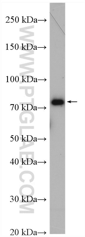 MTMR12 Antibody in Western Blot (WB)
