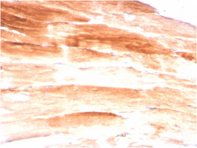 Dystrophin (DMD) (Marker of Duchenne and Becker Muscular Dystrophy) Antibody in Immunohistochemistry (Paraffin) (IHC (P))