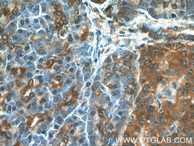 RIP3 Antibody in Immunohistochemistry (Paraffin) (IHC (P))