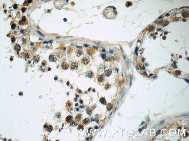 TSGA14 Antibody in Immunohistochemistry (Paraffin) (IHC (P))