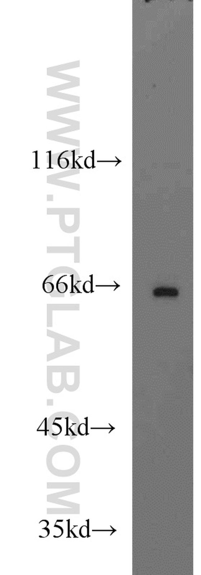 ST7L Antibody in Western Blot (WB)