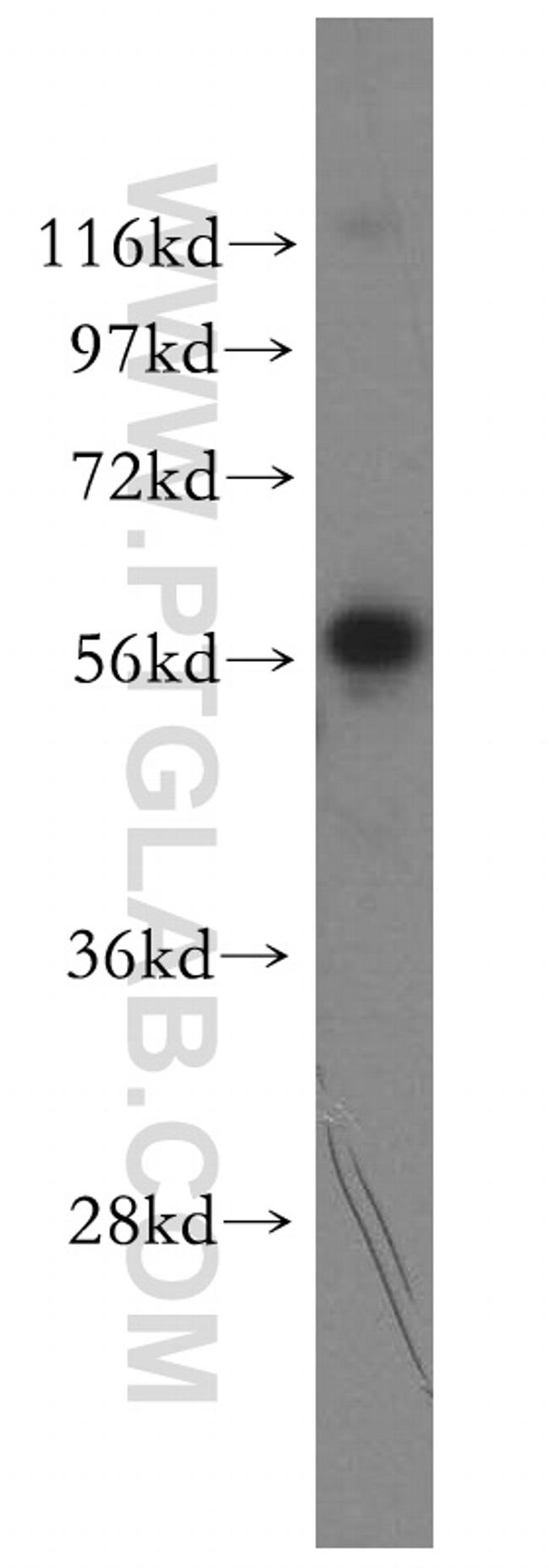 PLEKHA9 Antibody in Western Blot (WB)