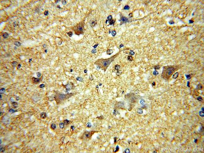 MCTP2 Antibody in Immunohistochemistry (Paraffin) (IHC (P))