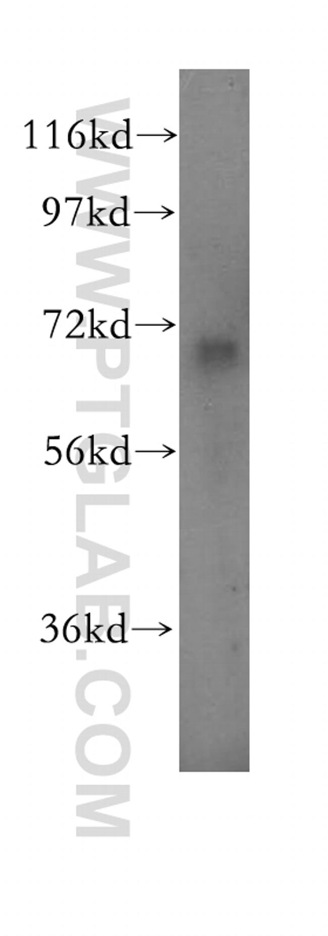 ADCK5 Antibody in Western Blot (WB)