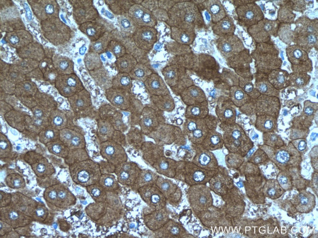 PKLR Antibody in Immunohistochemistry (Paraffin) (IHC (P))