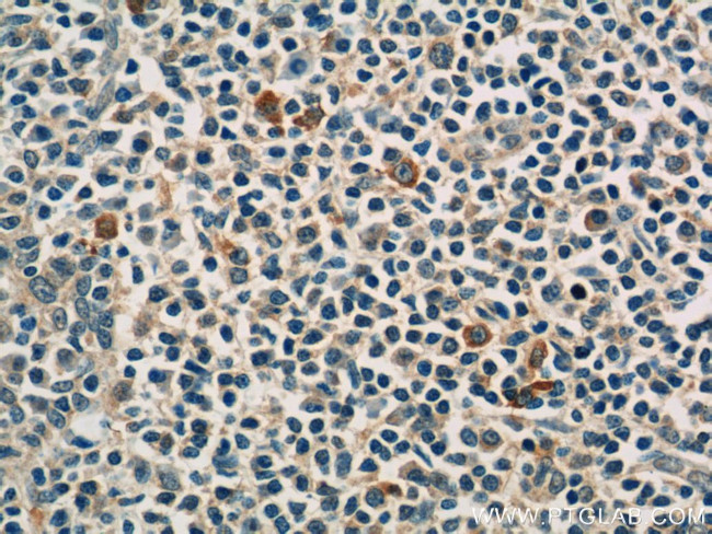 KIR3DX1 Antibody in Immunohistochemistry (Paraffin) (IHC (P))