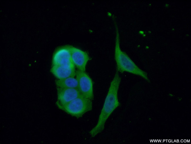 CDAN1 Antibody in Immunocytochemistry (ICC/IF)