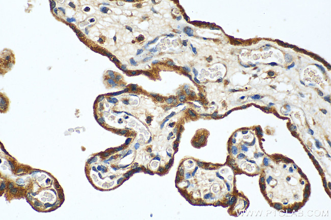 SLC39A9 Antibody in Immunohistochemistry (Paraffin) (IHC (P))