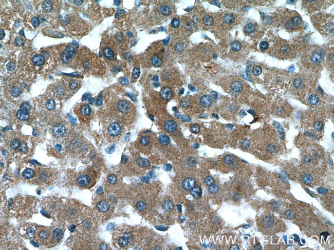AKT2 Antibody in Immunohistochemistry (Paraffin) (IHC (P))