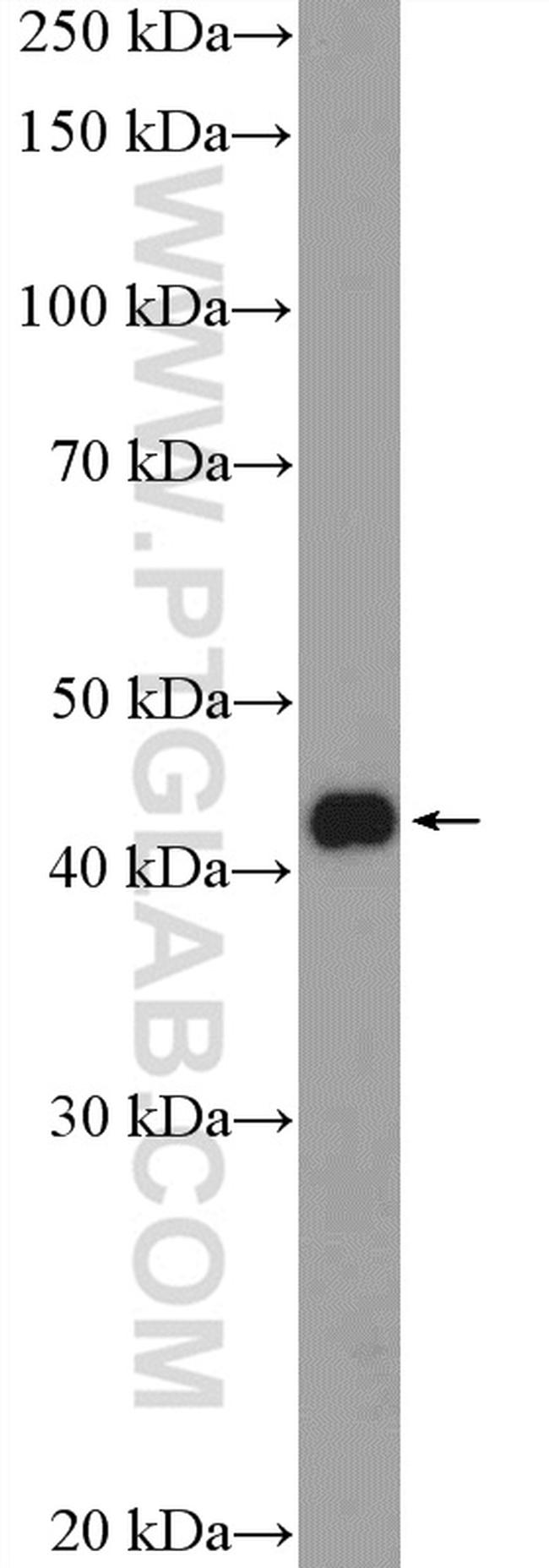 KLF17 Antibody in Western Blot (WB)