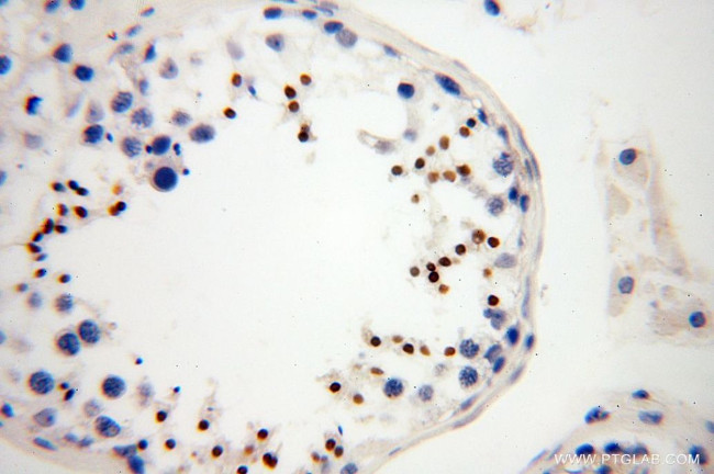 HEMGN Antibody in Immunohistochemistry (Paraffin) (IHC (P))