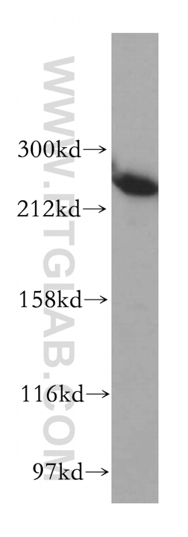 ASCC3 Antibody in Western Blot (WB)