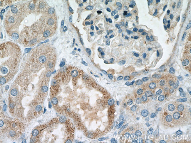 MSRB2 Antibody in Immunohistochemistry (Paraffin) (IHC (P))