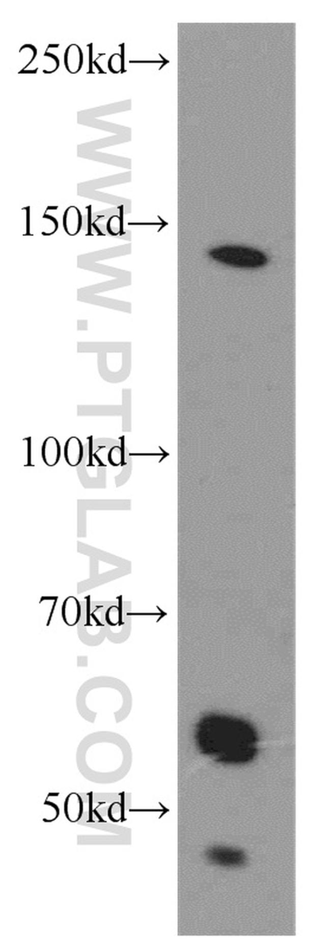 CDON Antibody in Western Blot (WB)