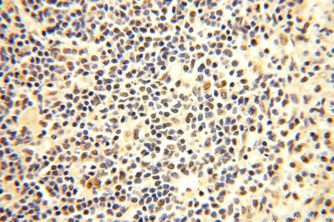 PGBD3 Antibody in Immunohistochemistry (Paraffin) (IHC (P))