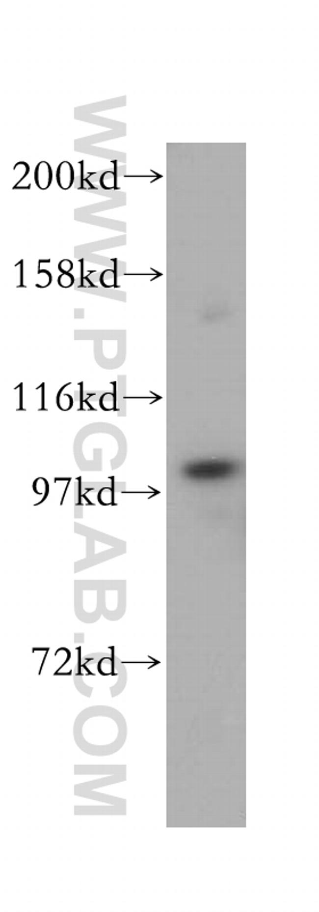 C7 Antibody in Western Blot (WB)