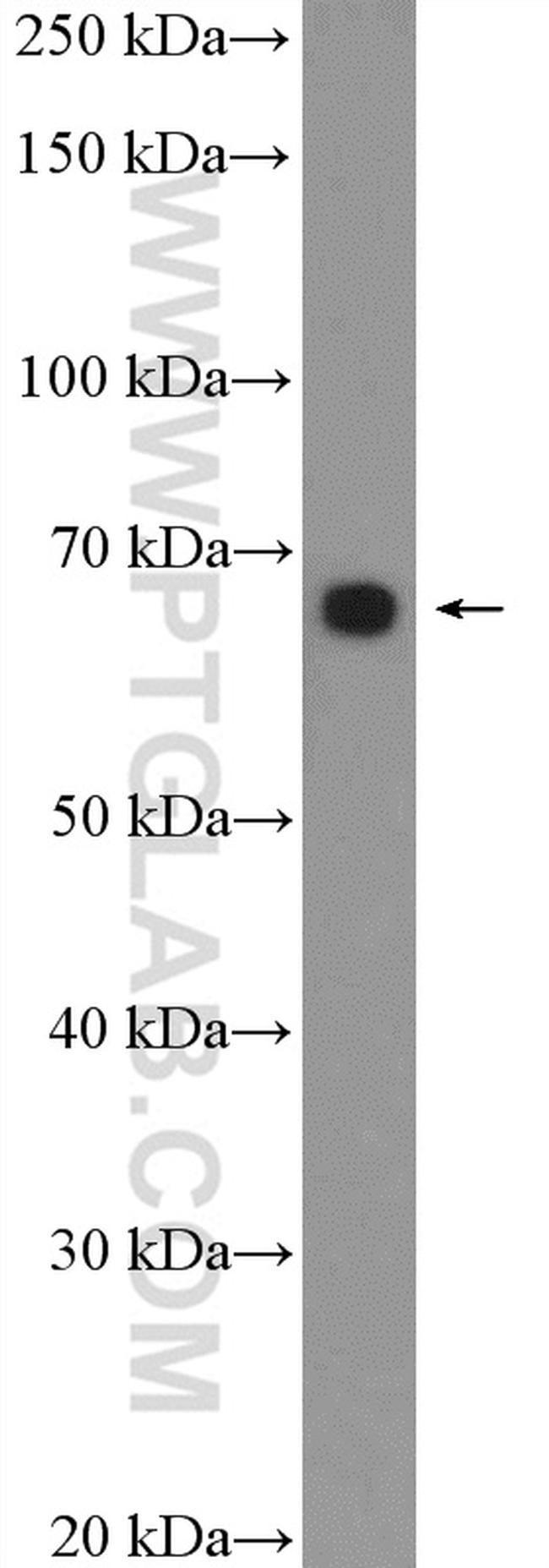 GRHL1 Antibody in Western Blot (WB)
