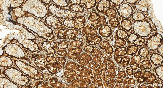 TIAR Antibody in Immunohistochemistry (Paraffin) (IHC (P))