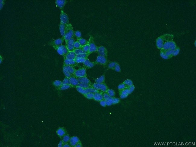 PAAF1 Antibody in Immunocytochemistry (ICC/IF)