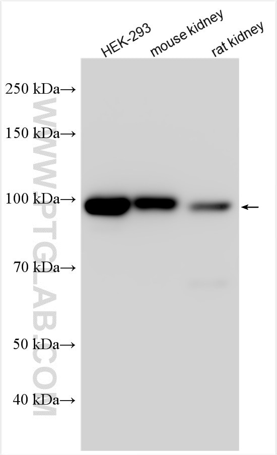 SLC26A7 Antibody in Western Blot (WB)