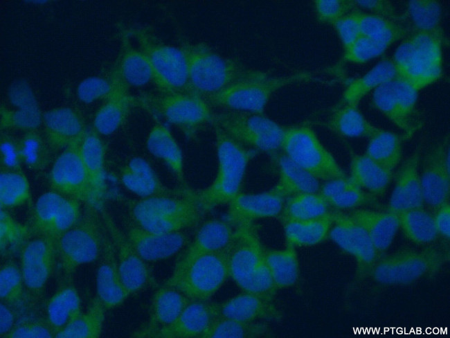RANBP6 Antibody in Immunocytochemistry (ICC/IF)