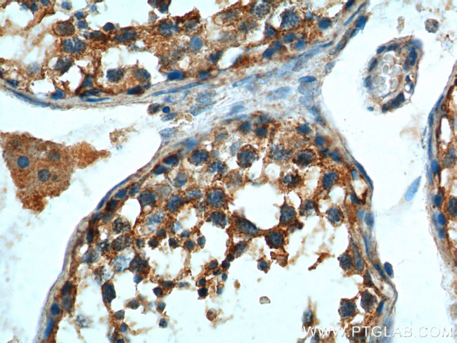 LGR6 Antibody in Immunohistochemistry (Paraffin) (IHC (P))