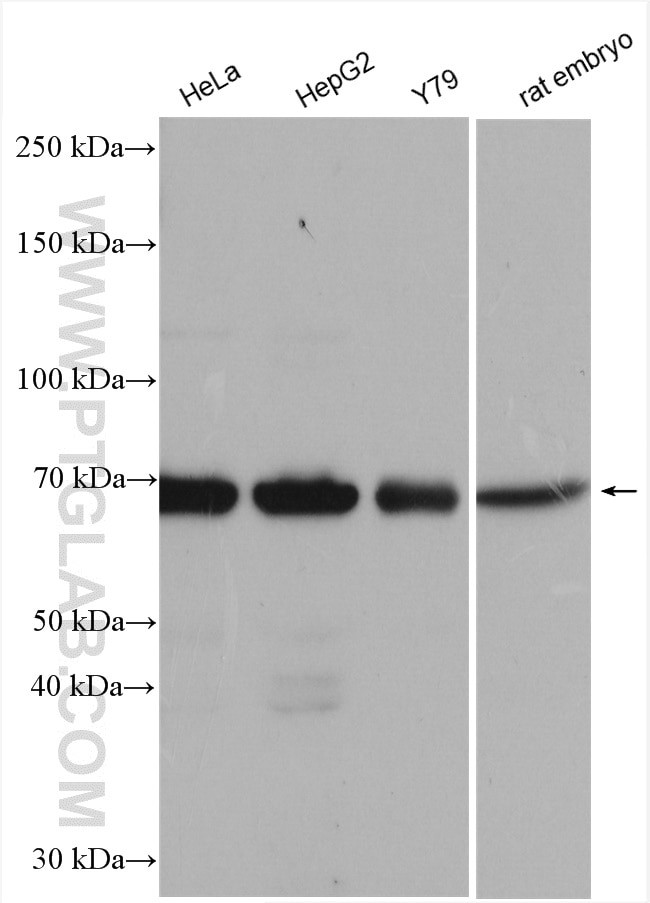 SENP3 Antibody in Western Blot (WB)