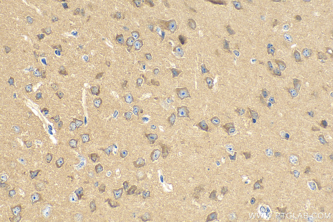 CPNE2 Antibody in Immunohistochemistry (Paraffin) (IHC (P))