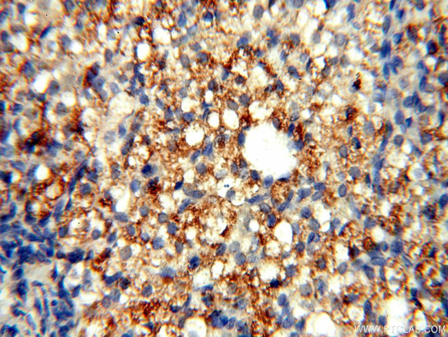TYW1B Antibody in Immunohistochemistry (Paraffin) (IHC (P))