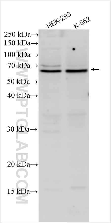 CDCA7L Antibody in Western Blot (WB)