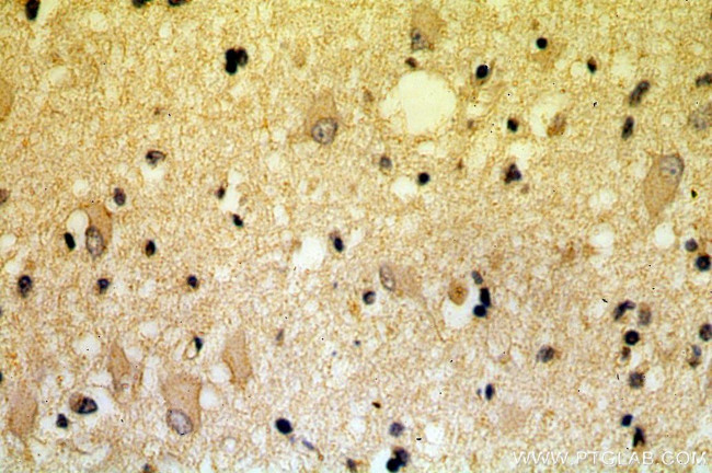 KLC2 Antibody in Immunohistochemistry (Paraffin) (IHC (P))
