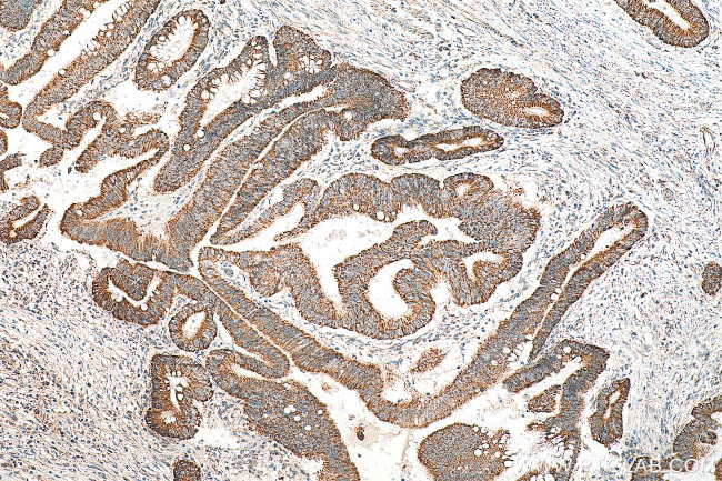 MRPL55 Antibody in Immunohistochemistry (Paraffin) (IHC (P))
