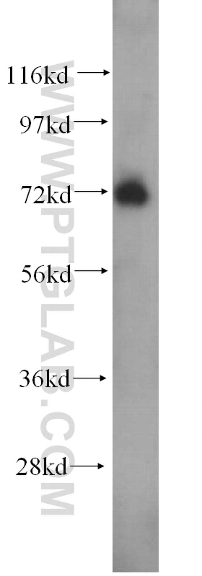 PJA1 Antibody in Western Blot (WB)