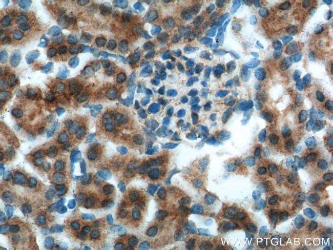OCRL Antibody in Immunohistochemistry (Paraffin) (IHC (P))