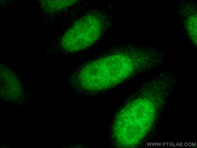 CDCA2 Antibody in Immunocytochemistry (ICC/IF)