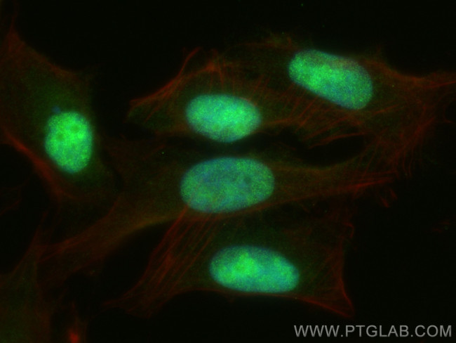 REV1 Antibody in Immunocytochemistry (ICC/IF)