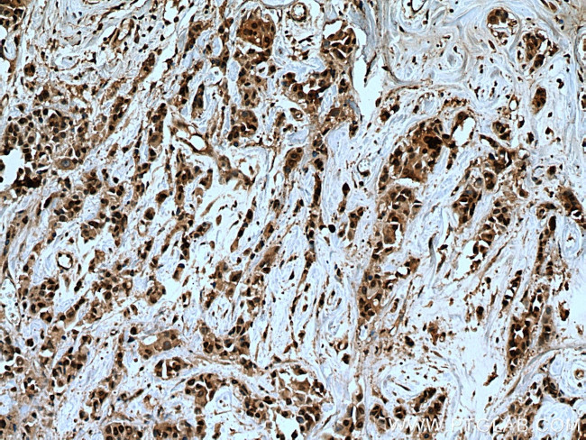 USP28 Antibody in Immunohistochemistry (Paraffin) (IHC (P))