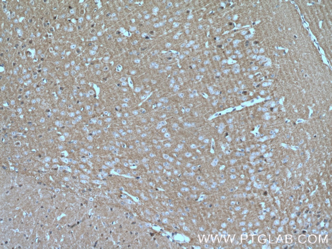 MPP5 Antibody in Immunohistochemistry (Paraffin) (IHC (P))