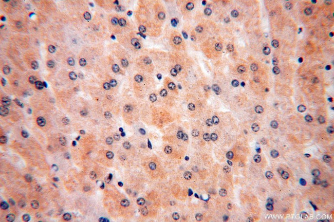 ULBP1 Antibody in Immunohistochemistry (Paraffin) (IHC (P))